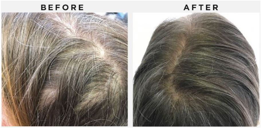 Behandlung mit Apriline Hair – Cosmetic4you Kosmetikstudio in Walliselle mit Apriline Hair Behandlung